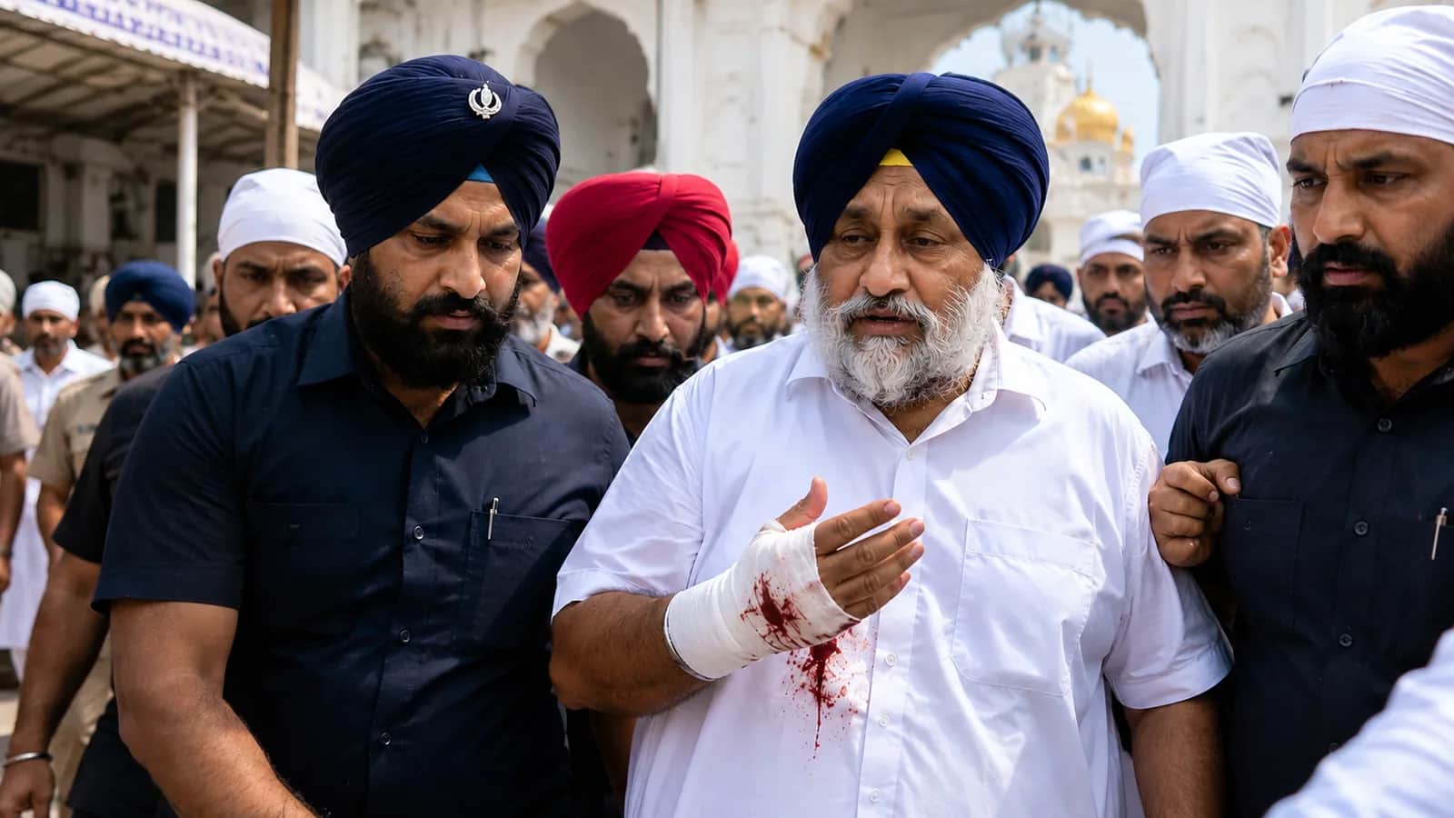 Sukhbir Badal injured
